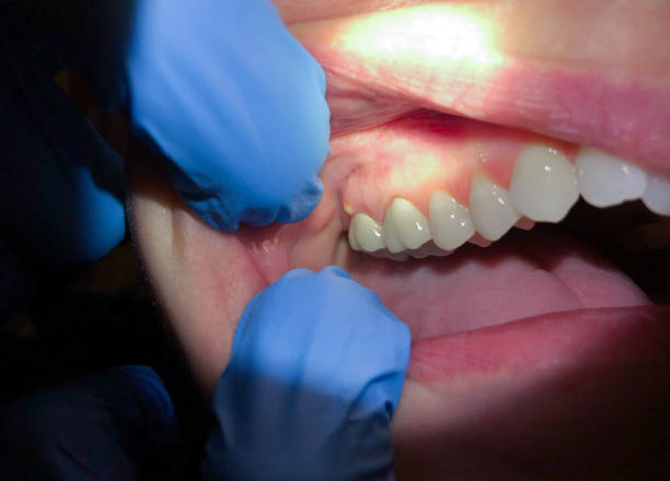 Best Weekend Emergency Dentist in Baltic, CT