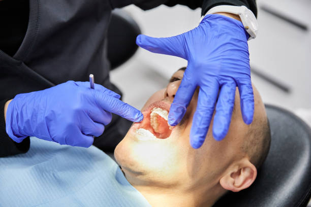 Best Emergency Treatment for Toothache in Baltic, CT